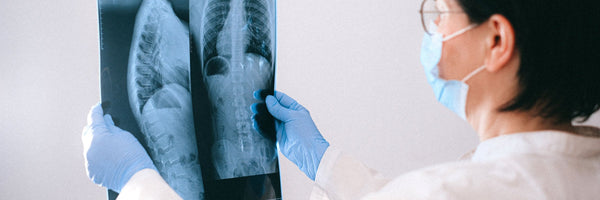Jeremy Clarkson Says Lie to Your Doctor — Do Cancer Screens Save Lives?